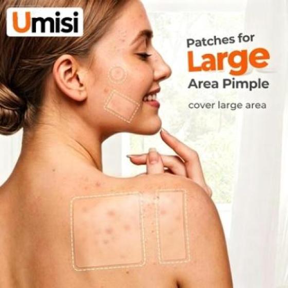 Large Size Deep Cystic Acne Patches